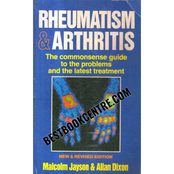 rheumatism and arthritis