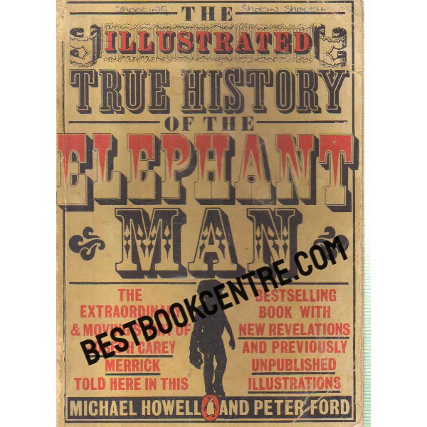 true history of the elephant man