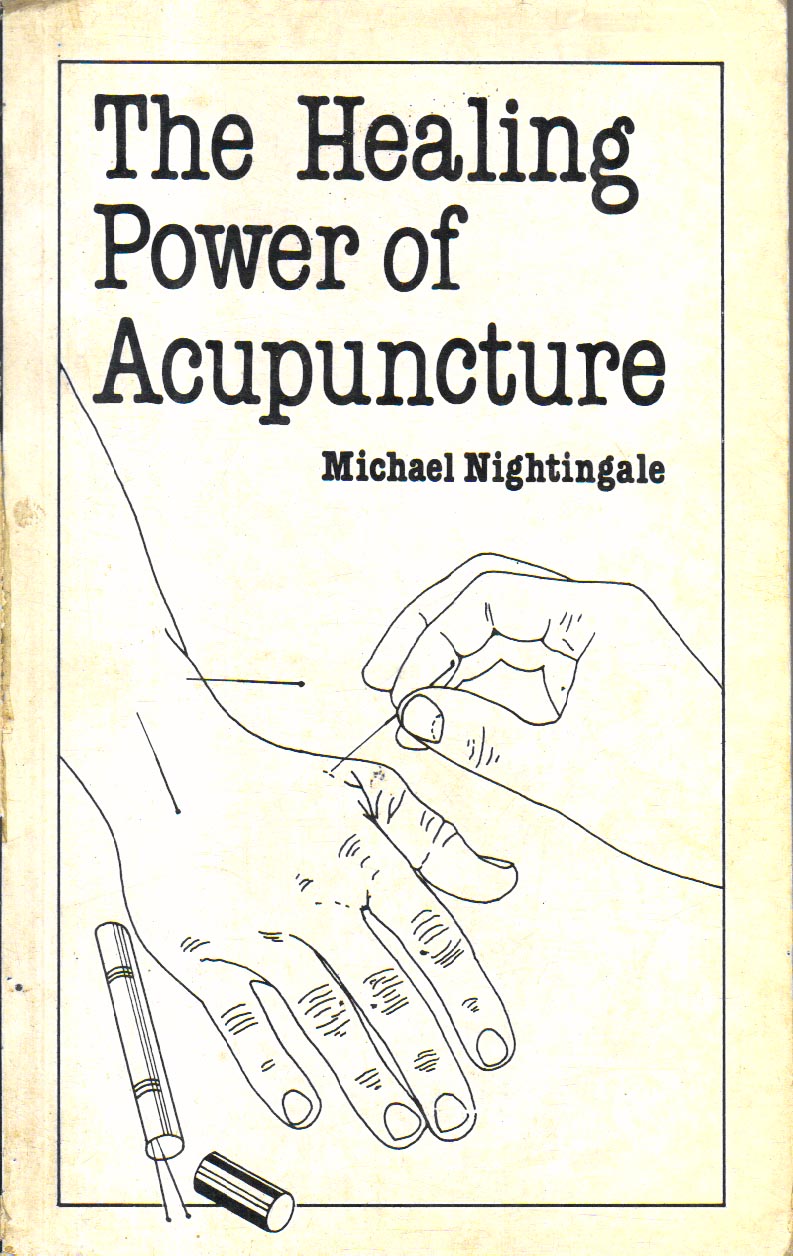 The Healing Power of Acupuncture
