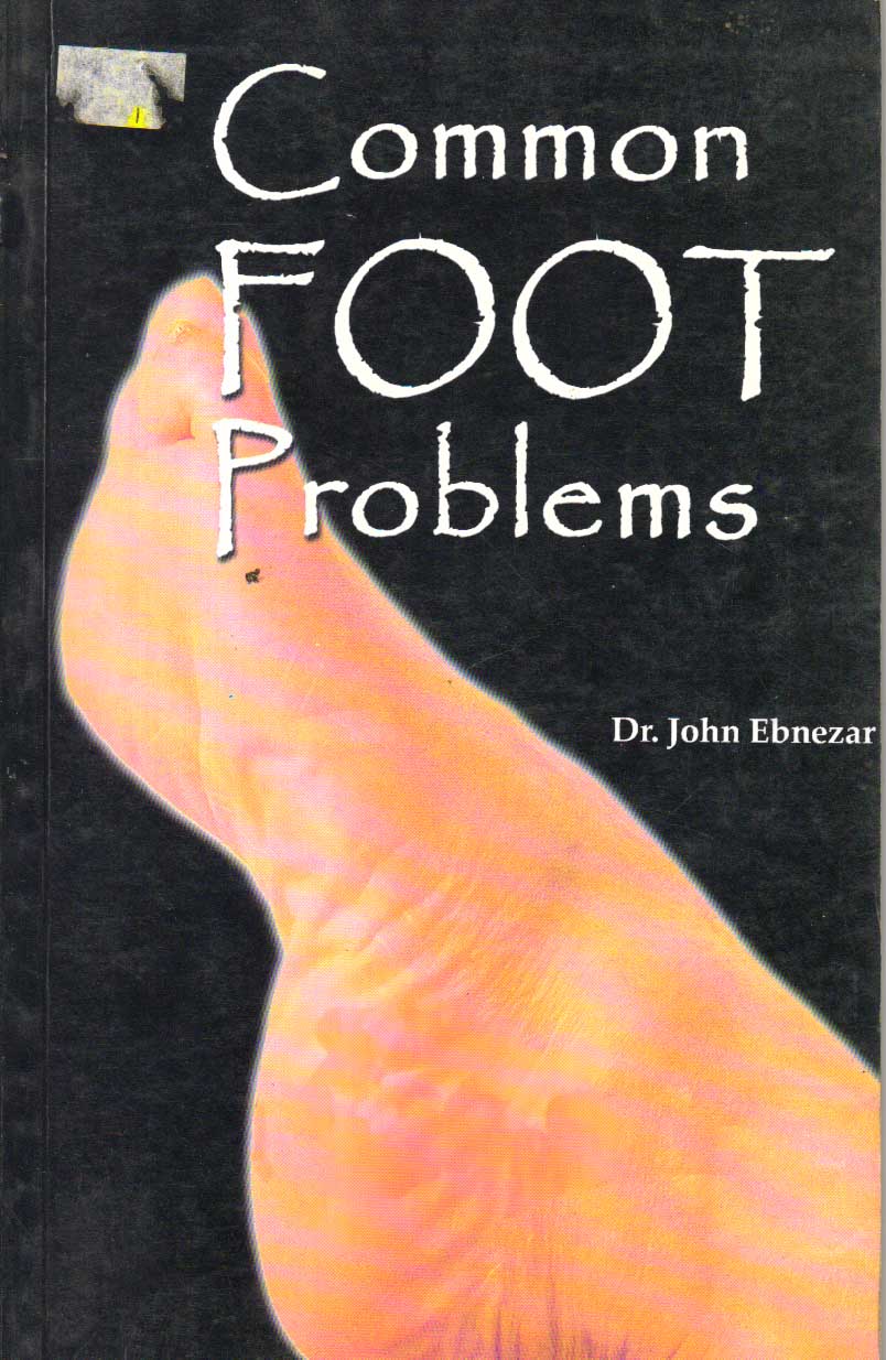 Common Foot Problems